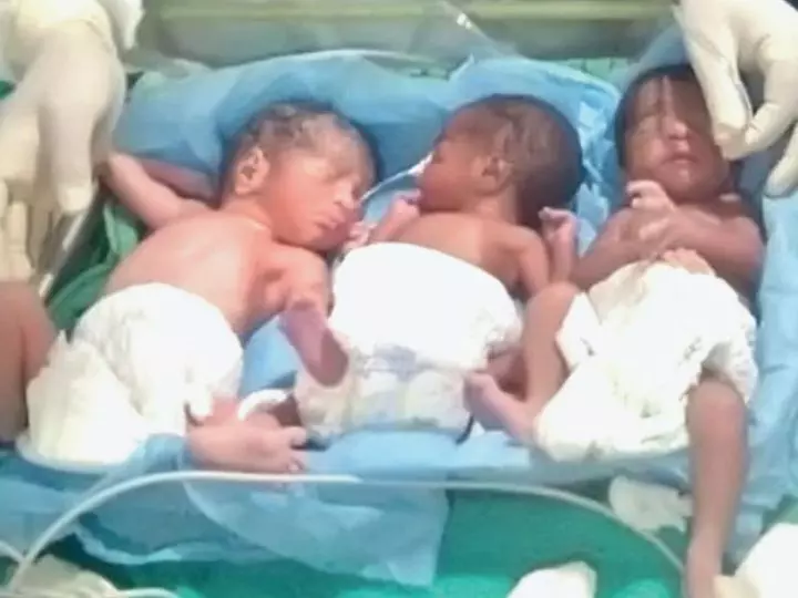 कोरोना पाॅजिटिव महिला ने तीन स्वस्थ बच्चों को दिया जन्म