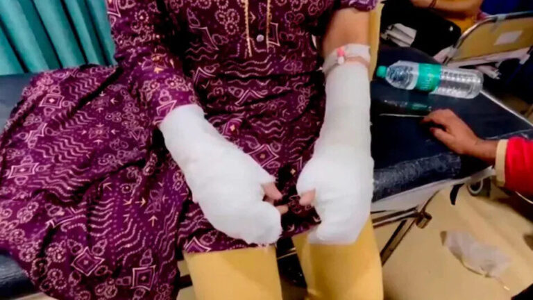 दिल्ली यूनिवर्सिटी की छात्रा पर ‘एसिड अटैक’ का मामला निकला फर्जी, पिता ने रची थी साजिश