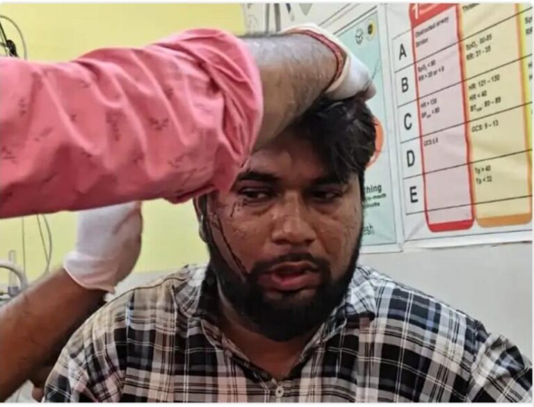 हाईवे पर भीषण हादसा: एक ही परिवार के चार लोग घायल, महिला की हालत गंभीर